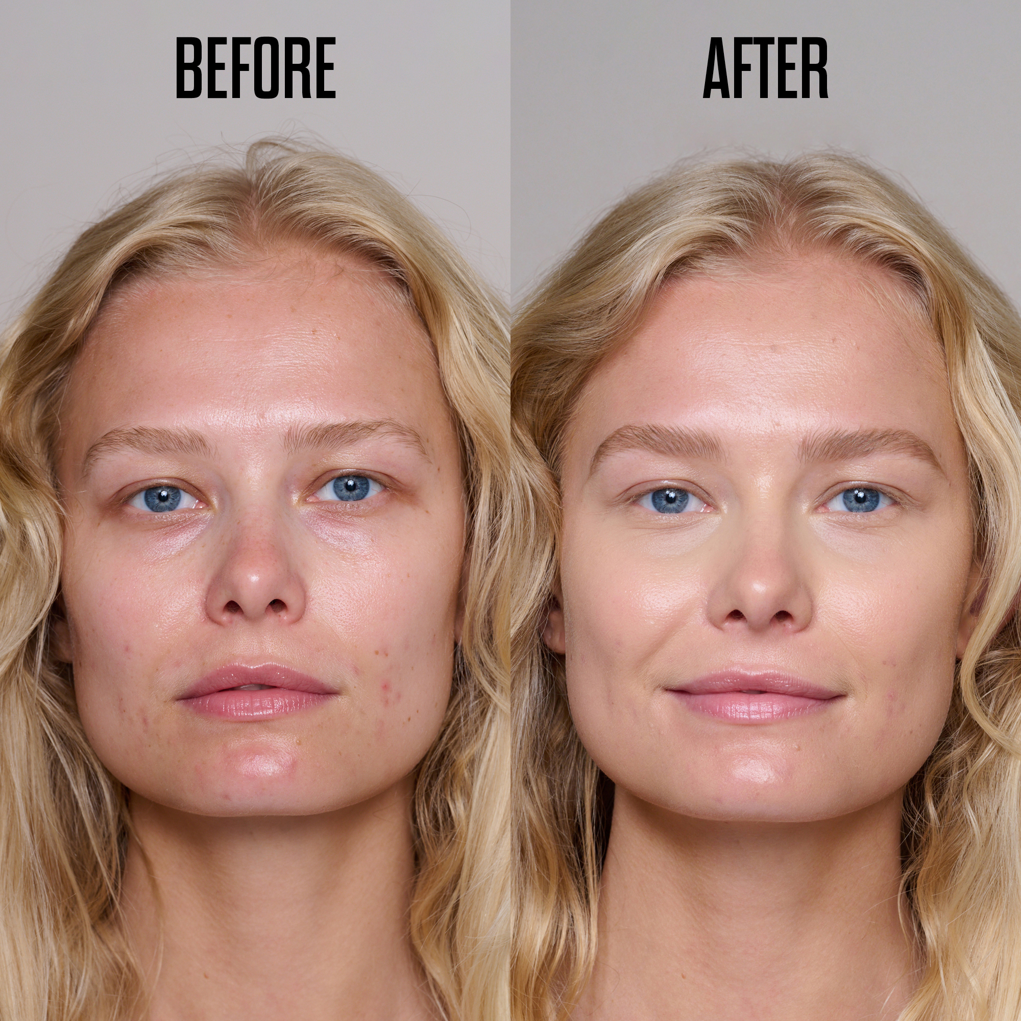 BBS1_Before_And_After_11_2000x2000