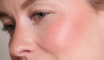 Model wearing Colour Wonder Lip and Cheek Balm in Au Naturalle