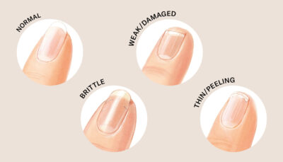 Nail types infographic 